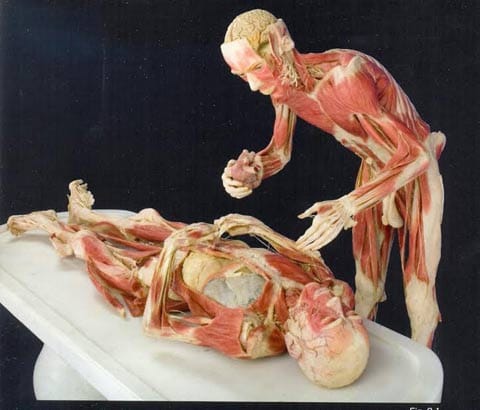 Gunther von Hagens, Surgery in Still Life, Body Worlds, 2007